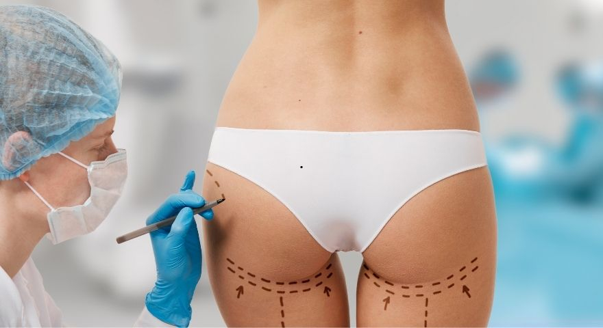 Buttock Aesthetics (BBL)