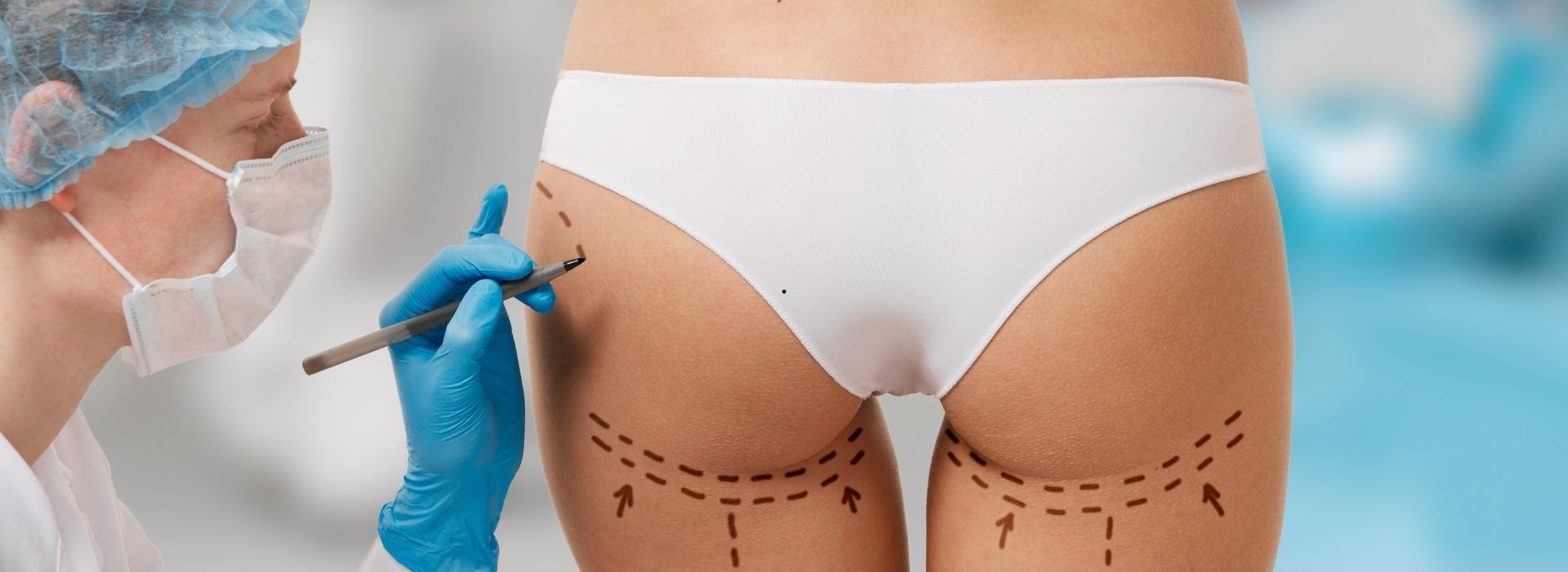 Buttock Aesthetics (BBL)